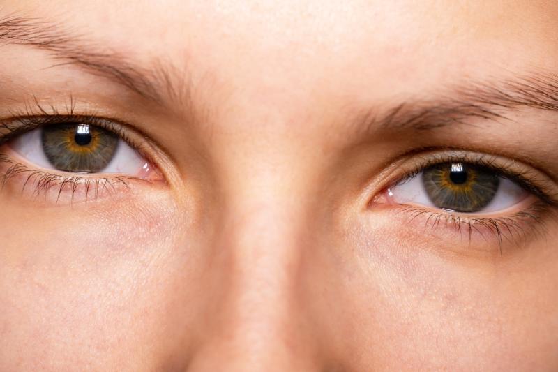 Heterochromia wady wzroku