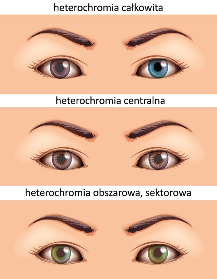 Psychologia różnokolorowych oczu