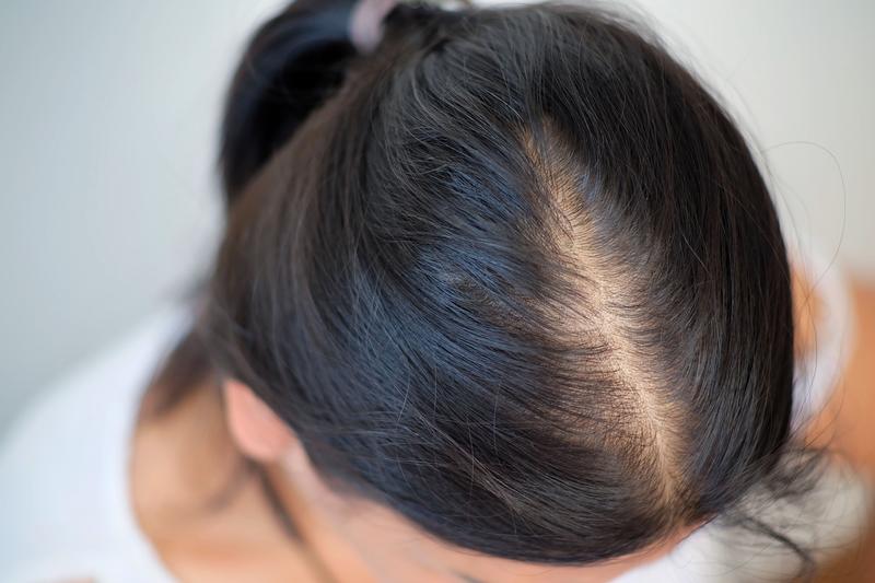 Profilaktyka wypadania włosów