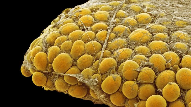 Psychologia odchudzania