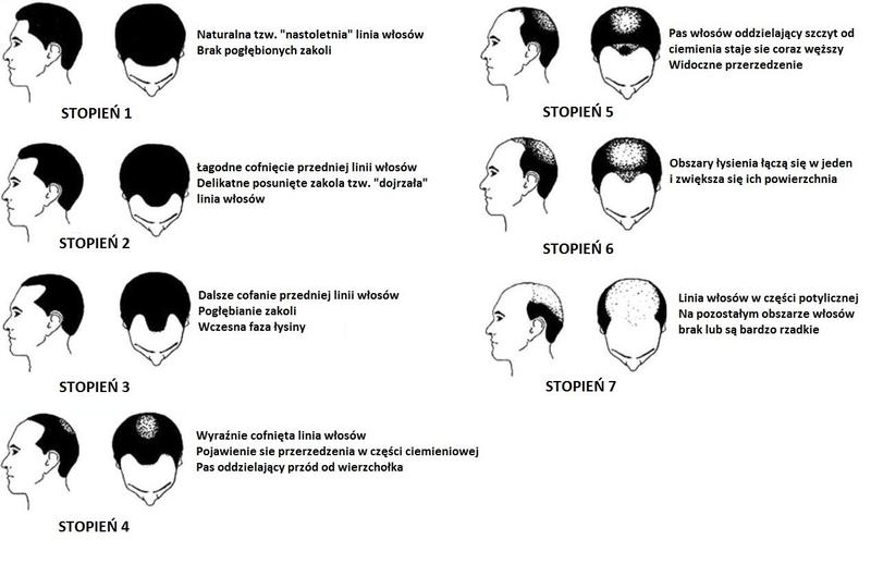 Składniki odżywcze na łysienie
