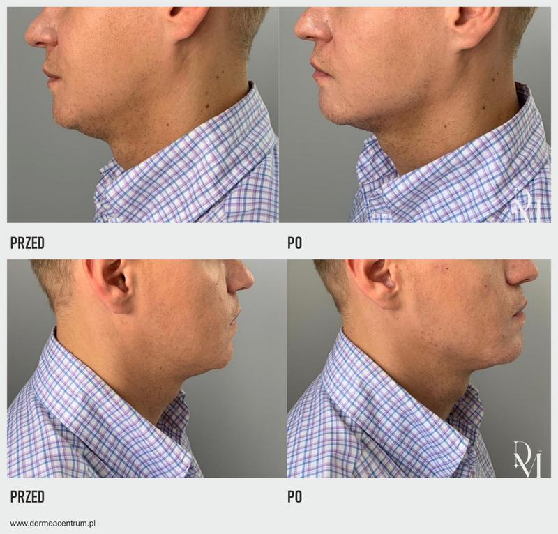 Styl i wygląd zewnętrzny mężczyzny