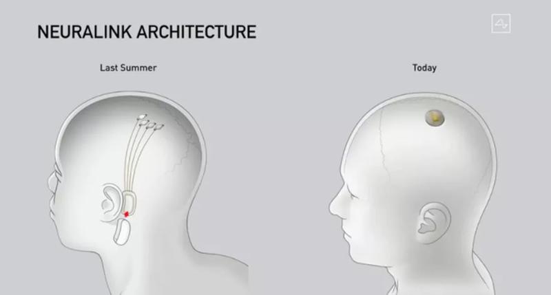 Etyka technologii mózgowej